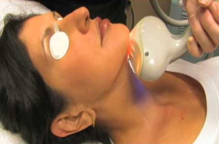 نتیجه تصویری برای لیزر درمانی برای لیفت گردن